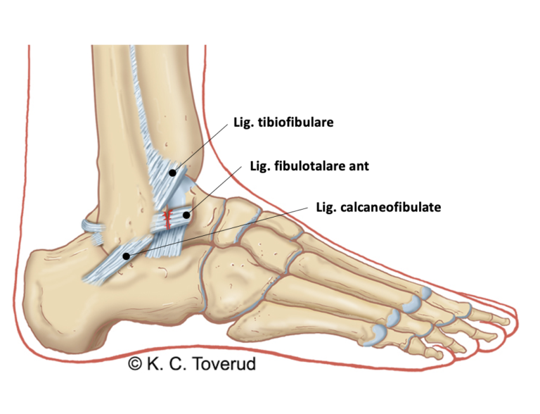 Ligamentskade Ankel BevApp Ligamentskade Ankel BevApp